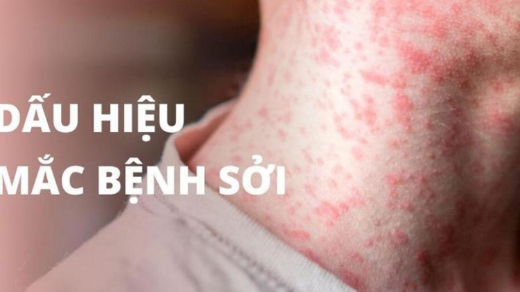 Athei ƀet vắc-xin vă tang găn jĭ grŏnh