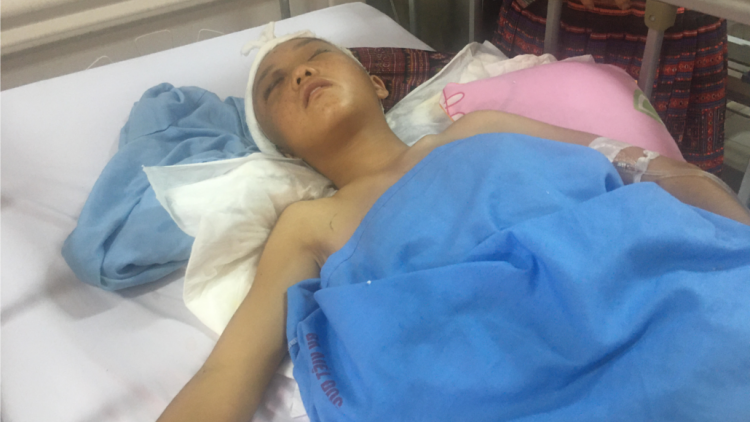 Chung tay cứu bé người Mông bị chấn thương sọ não