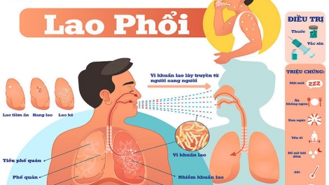 A NGẮT LÂNG HIV VÊY CHOOM PA DƯAH CĂH?