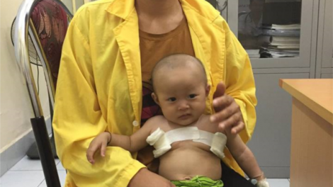 Cháu Lường Thị Thoa, 7 tháng tuổi bị nhiều căn bệnh cần được giúp đỡ