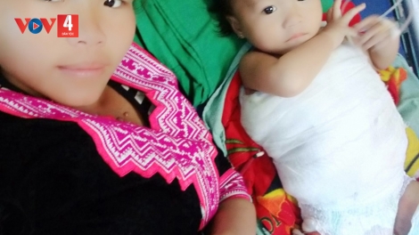 Giúp cháu bé dân tộc Mông 13 tháng tuổi bỏng nặng