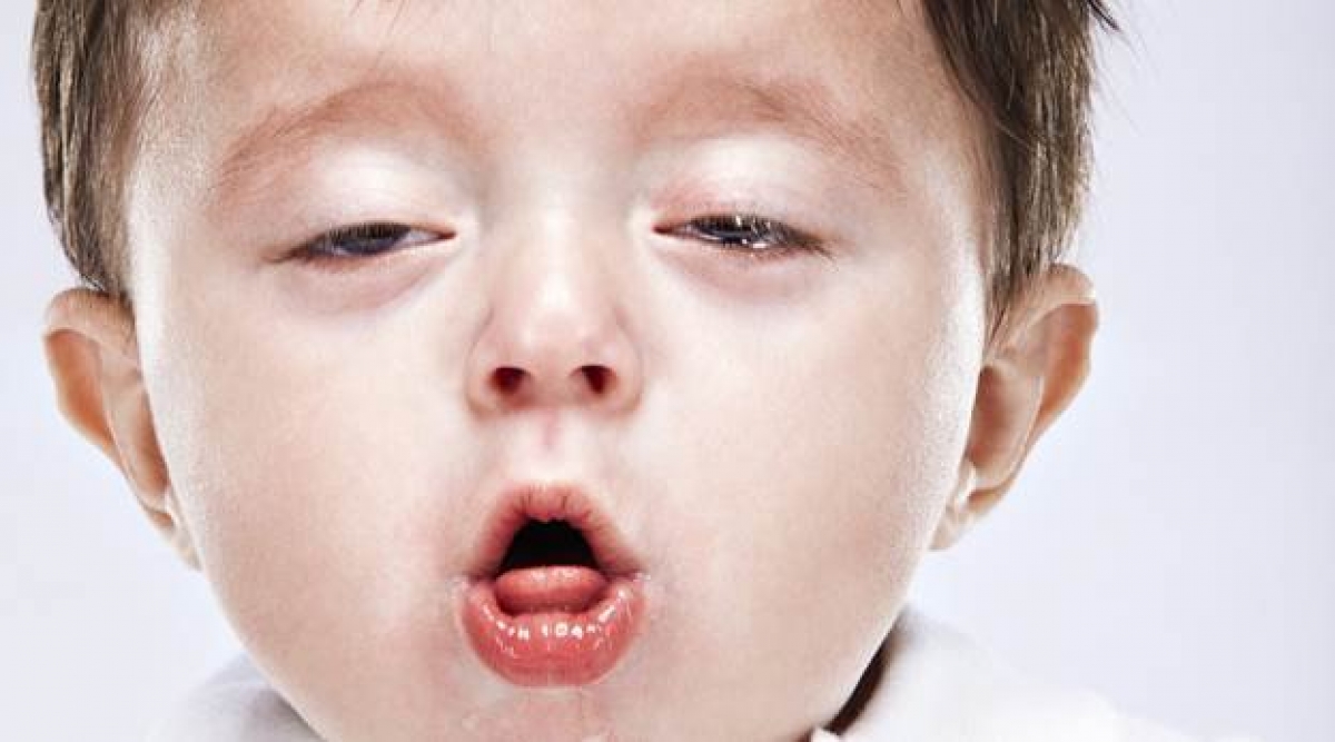 Những cơn ho xuất hiện nhiều làm trẻ yếu dần như ngừng thở do thiếu oxy