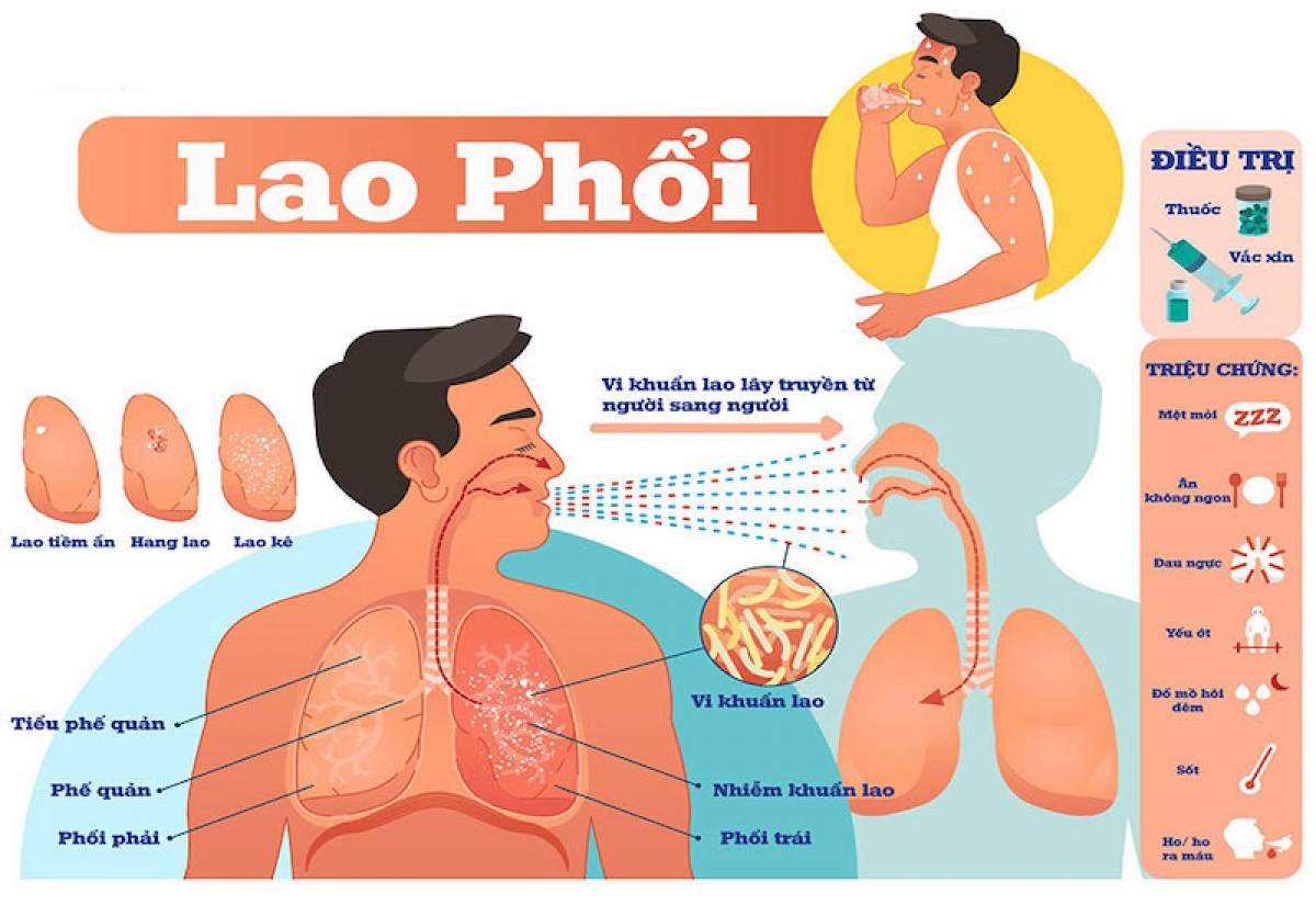 Nguồn ảnh: Internet